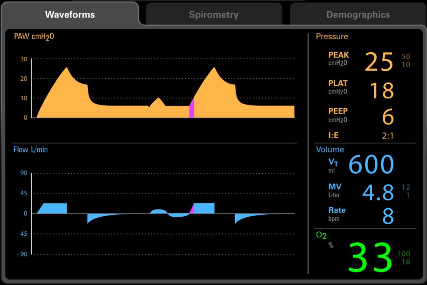 Waveforms Tab System Interface 3.4 Waveforms Tab Displays PAW (cmh 2 O) and Flow (L/min) waveforms. (FIGURE 3-12) Waveforms Tab FIGURE 3-12 Main Screen Waveforms Tab 3.4.1 Waveform Color WAVEFORM COLOR Orange Cyan Purple TABLE 3-1 Waveform color DESCRIPTION Indicates the color of the Paw waveform.
