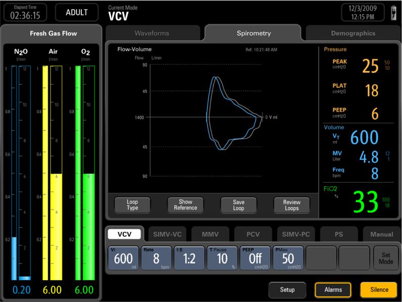 The system provides two spirometry loops: P-V (Paw-volume) loop and F-V (flow-volume) loop. Data of P-V and F-V loops come from pressure and flow data. Only one loop is displayed at a time.