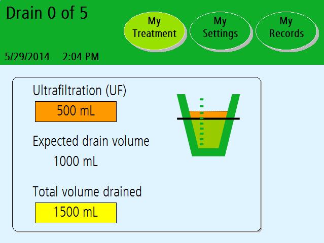 Draining Exchange: Drain 0 Ultrafiltration (UF) Expected drain volume Total volume drained Note: The values shown here