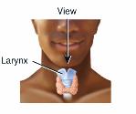 The vocal folds are situated high in the larynx just below where the larynx and the esophagus split off from the pharynx.