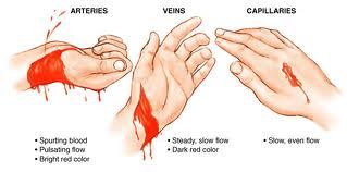 Bleeding Arterial Bright red color Spurting Failure to clot or stop easily Decrease in pressure as patient s blood pressure drops