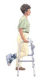 Using a Walker To use your walker, you will need to learn a new way to walk (gait).