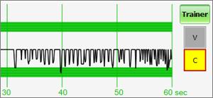 PERFORMANCE EXAMPLES Compressions are too shallow. Most waveform peaks do not reach the green zone. Compression indicator is yellow.