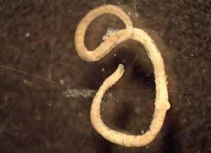Aquatic Worms: Class Oligochaeta Elongated,