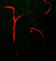 Center: Two-photon imaging of a transgenic mouse expressing eyfp in mitral cells somata and dendrites