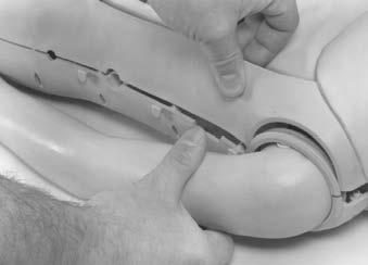 (See figure 3.) 3. Pull the retaining ring apart and remove it from the arm. 4. Reassemble the retaining ring through the hole in the shoulder assembly of the Child Injectable Training Arm.