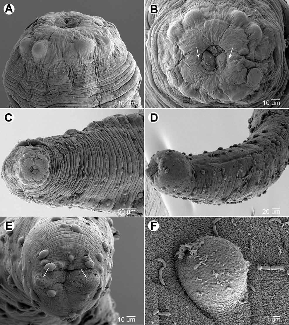 Moravec et al.: Two philometrids from Japan A B C D E F Fig. 4. Philometroides branchiostegi sp. n., scanning electron micrographs of gravid female.