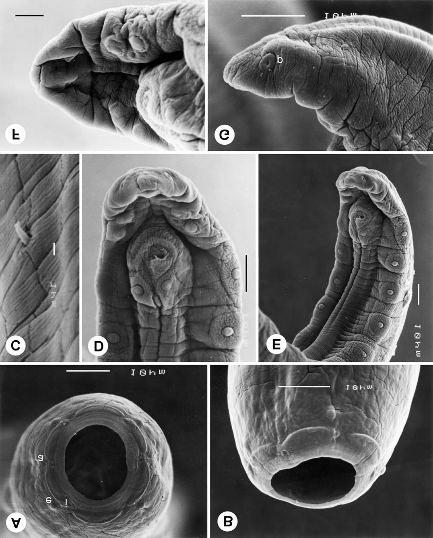 Moravec et al.: Nematodes of fishes from China Fig. 2. Procamallanus (Spirocamallanus) fulvidraconis Li, 1935, scanning electron micrographs.