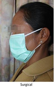 Discussion surgical mask Surgical masks thought to be the most distributed intervention