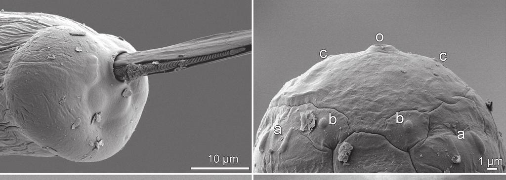Ahead of print online version Moravec et al.: New species of Philometra A B C D ig. 6. Philometra latispicula sp. n. from Lutjanus griseus, scanning electron micrographs.