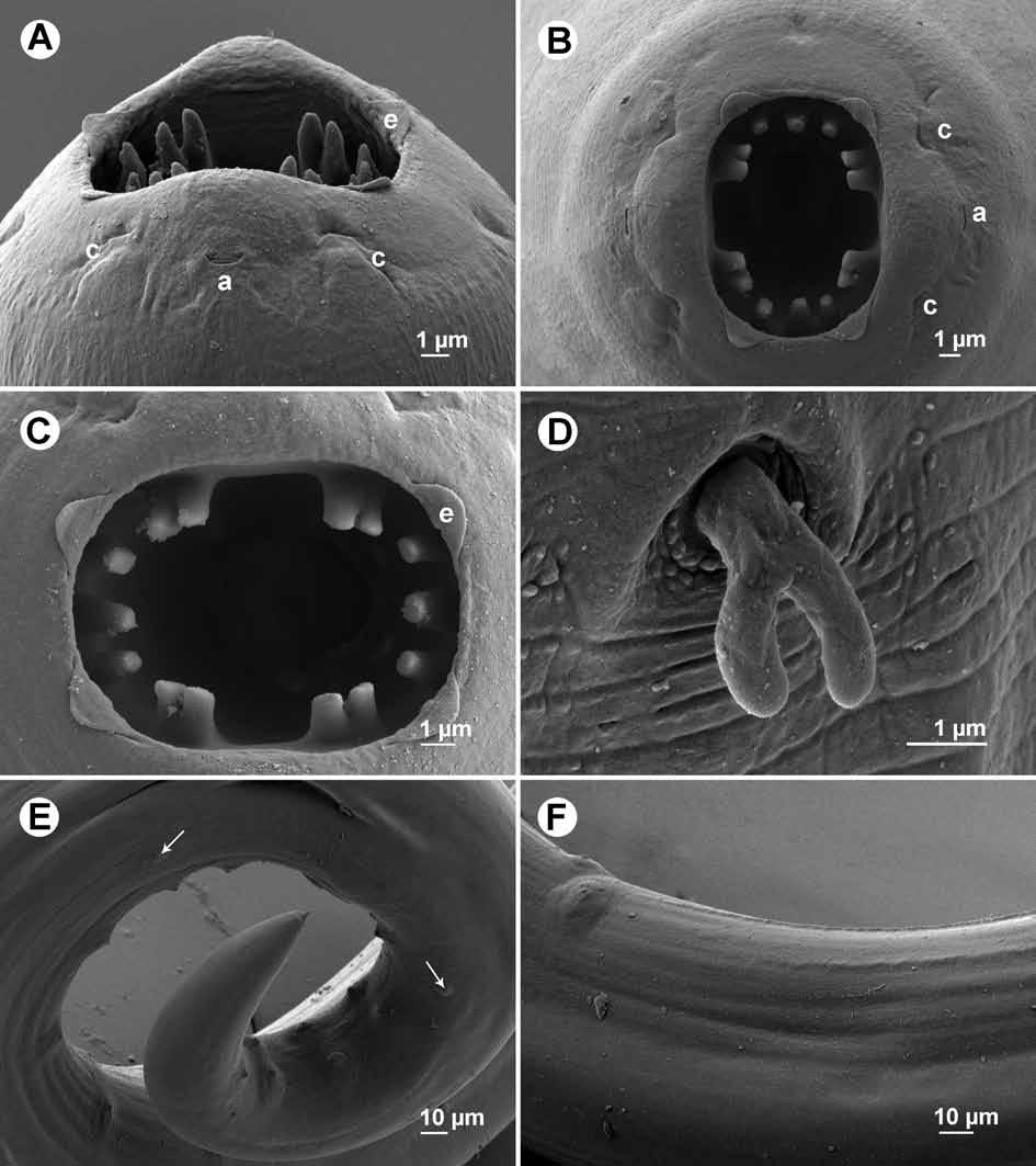 Moravec et al.: Three species of Rhabdochona Fig. 4. Rhabdochona hospeti Thapar, 1950 from Tor sp., scanning electron micrographs.