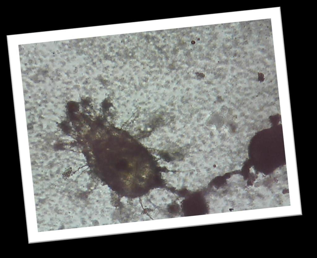 a) machuľa b) chrobák c)roztoč C, je správne! Na obrázku vidíte asi 0,2 mm živočícha, ktorého zaraďujeme medzi roztoče.