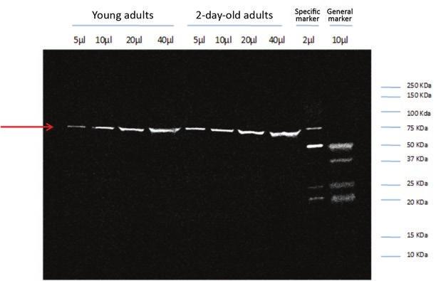 Figure 1. Detection of 5-α-R protein of C. elegans in different stages of development.