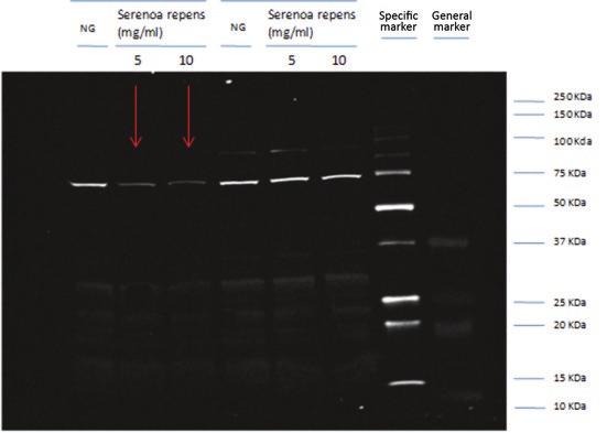 Relative quantification of the luminescence intensity starting from 10 μl C. elegans (two-day-old adults) protein preparations treated with Serenoa repens extract. Right panel.