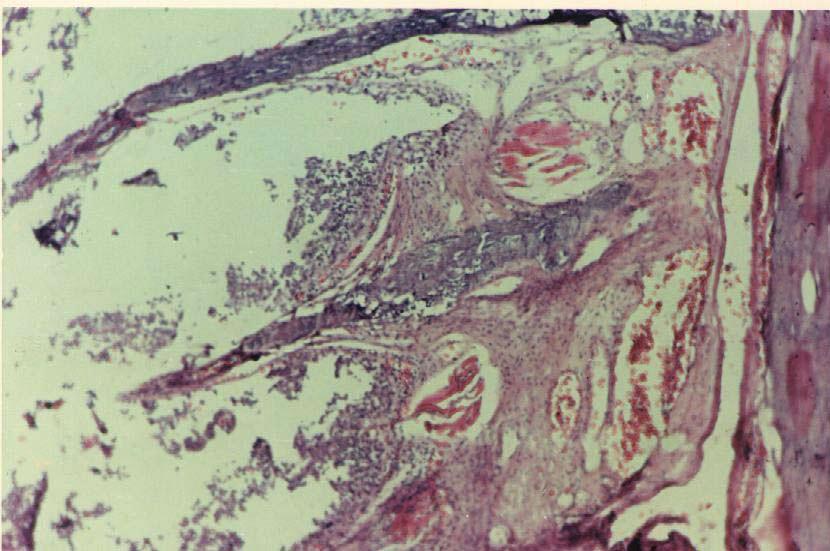 Fig. (7) Gills showing edema, congestion, and hemorrhage in the gill arch, necrosis