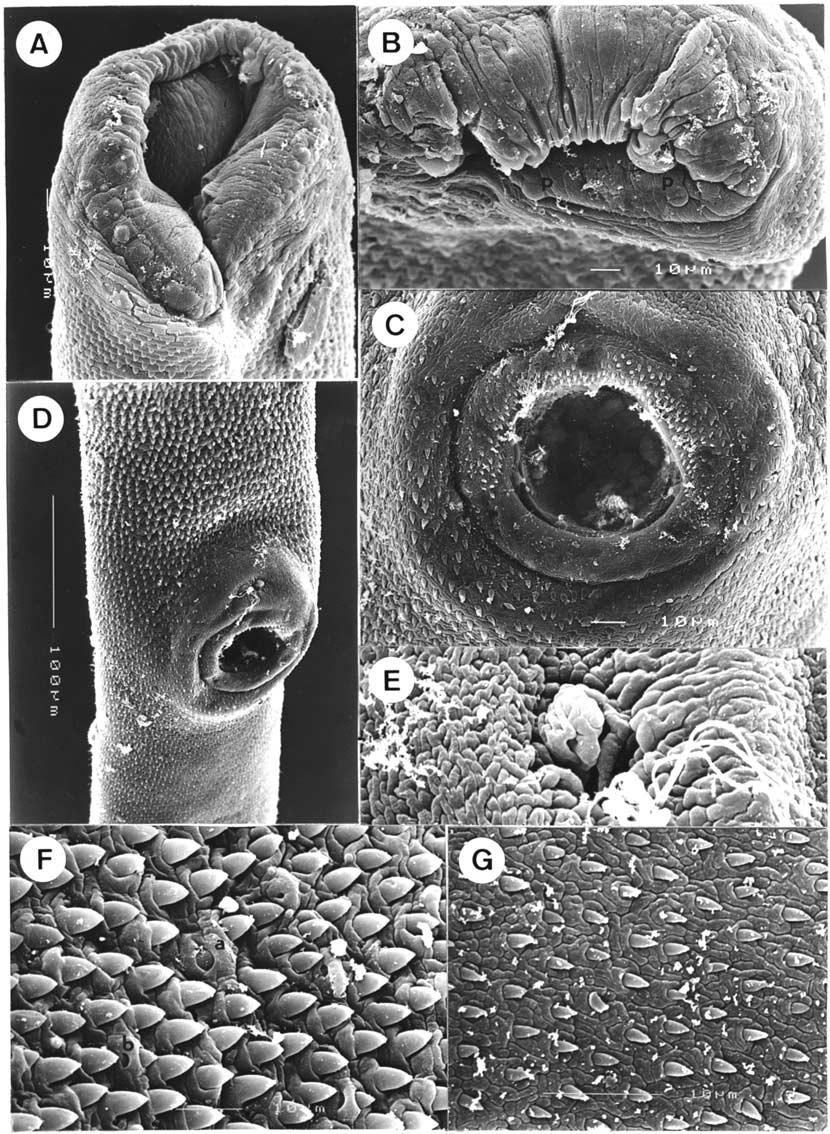 202 Figure 2. Perezitrema bychowskyi (Caballero & Caballero, 1975) from Atractosteus tropicus, Mexico, SEM micrographs.