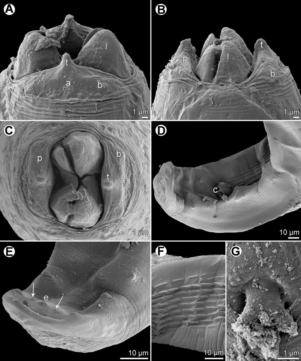 10 F. Moravec and J.-L. Justine: Parasite 2018, 25, 39 Figure 7. Rasheedia novaecaledoniensis n. sp. from P. indicus, scanning electron micrographs of male.