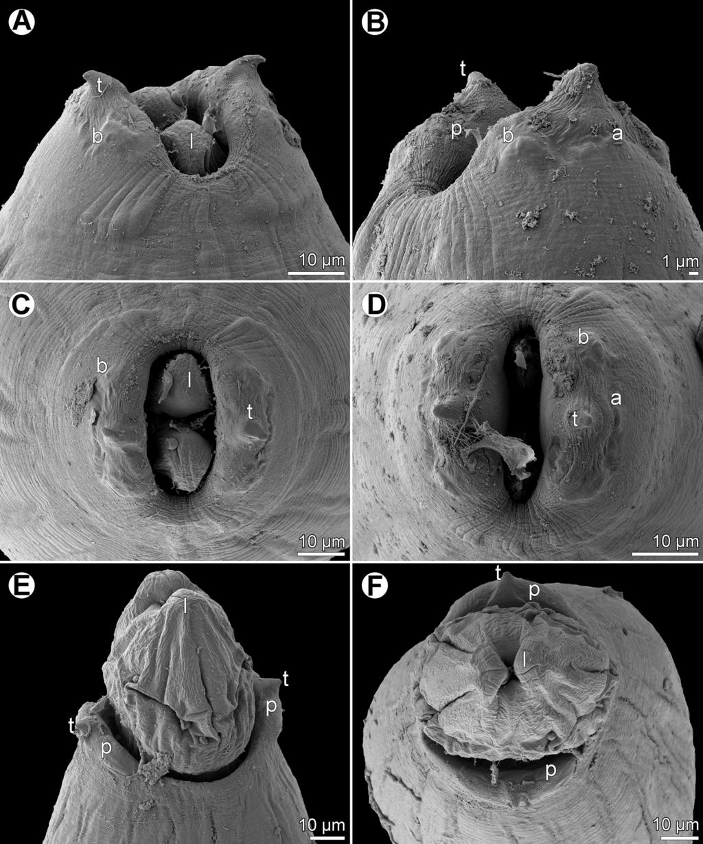 F. Moravec and J.-L. Justine: Parasite 2018, 25, 39 5 Figure 3. Rasheedia heptacanthi n. sp., scanning electron micrographs.