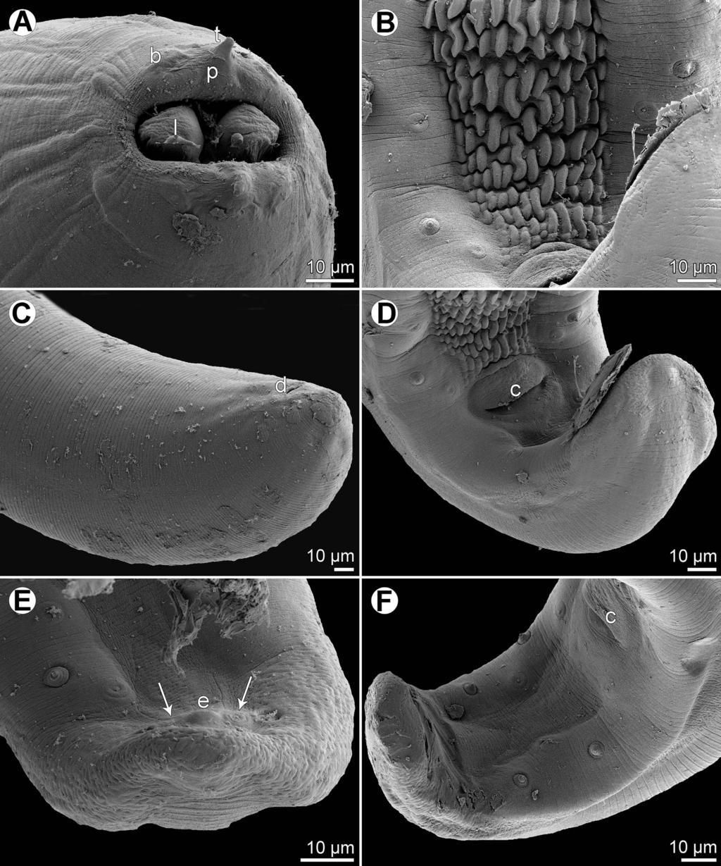6 F. Moravec and J.-L. Justine: Parasite 2018, 25, 39 Figure 4. Rasheedia heptacanthi n. sp., scanning electron micrographs.