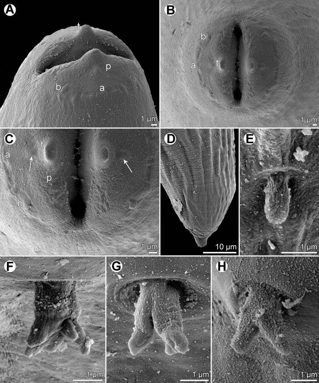 F. Moravec and J.-L. Justine: Parasite 2018, 25, 39 7 Figure 5. Rasheedia heptacanthi n. sp., scanning electron micrographs.