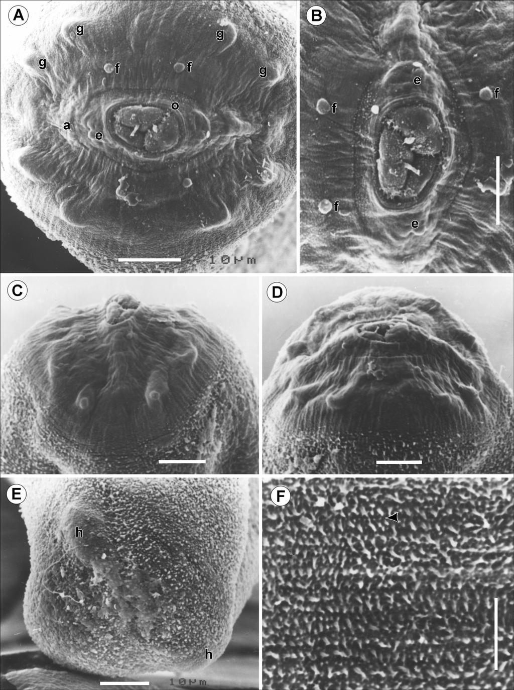 Fig. 2. Spirophilometra pacifica sp. n., scanning electron micrographs of gravid female.