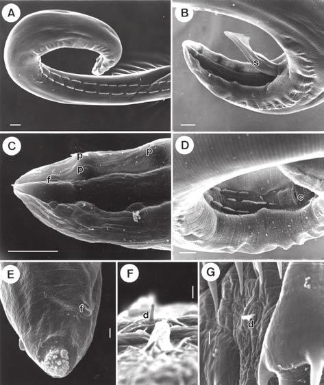 S. osorioi František Moravec et al. 55 maximum width 21; glandular oesophagus 972-1,290 long, maximum width 36-54; ratio 1:3.7-4.7. Length of vestibule and entire oesophagus represents 19-22% of body length.