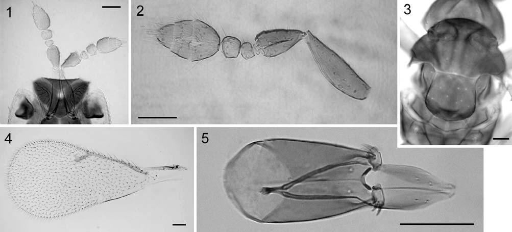 Figs 1 5: Ceranisus hirsutus sp. n. 1 female head and antennae; 2 male antenna; 3 female mesoscutum and scutellum; 4 female forewing; 5 male genitalia. Scale bars = 0.05 mm.