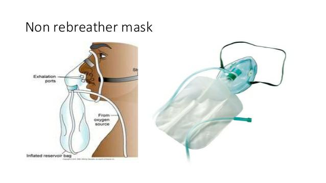 C. Non Rebreather Mask :- It is a Plastic Mask with Reservoir Beg. It Consist of One Way Valve Which Prevent Room Air & Exhale Air Enter into Beg.