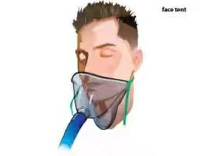 Face Tent :- Use :- Facial Trauma Flow Rate- 4-8 Liter/minute