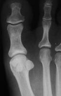 08,30 Beginning of the day 2 08,30-09,30 Lecture:hindfoot anatomy Trnka 09,30-10,30 Video:hindfoot surgery