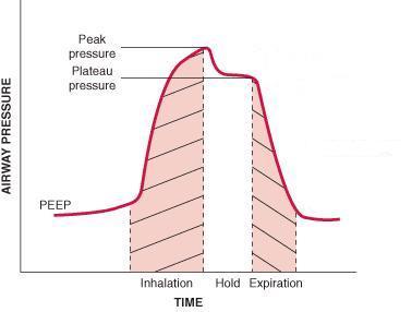 Pressure vs Time for Volume Cycled Ventilation 9. References: 1. Dries DJ: key questions in the ventilator management of the burn-injured patient. Journal of Burns Care and Research.