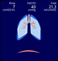 7.2 Dynamic Lung panel The Dynamic Lung panel (Figure 7-2) visualizes tidal volume, lung compliance, patient triggering, and resistance in realtime.
