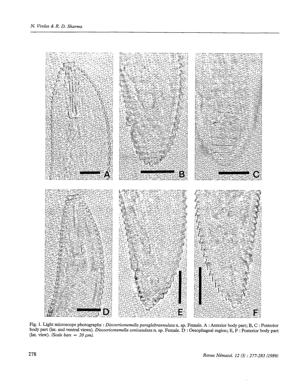 N. Vovlas & R. D. Sharma Fig. 1. Light microscope photographs : Discocriconemella paraglabrannulata n. sp. Female. A : Anterior body part; B, C : Posterior body part (lat.