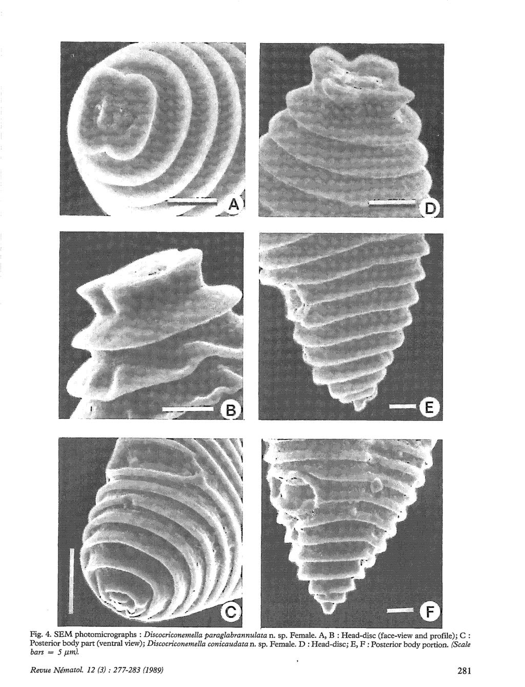 Fig. 4. SEM photomicrographs : Discocriconemella paraglabrannulata n. sp. Female.