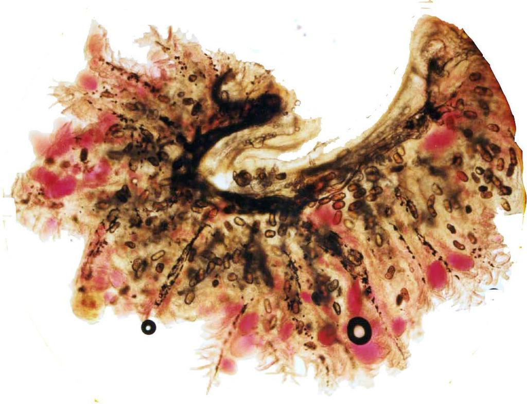In fish with numerous cysts, the filaments are shortened and thickened, there is epithelial hyperplasia, fusion of filaments, and lamellae engorged with red blood cells (Figure 10). Figure 10.