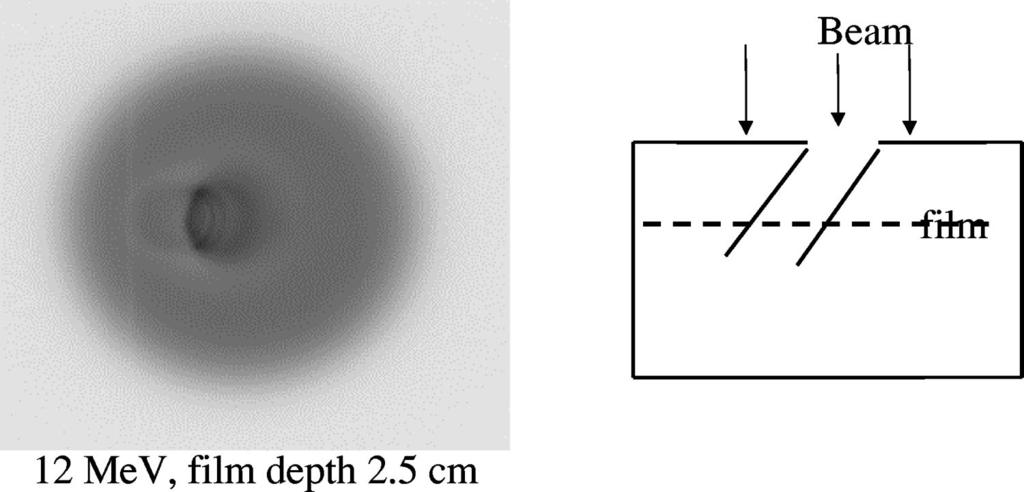 13 Yorke et al.: The dose distribution of medium energy electron boosts... 13 FIG. 5. The pattern on a film exposed to 12-MeV electrons at 2.5 cm below the surface of the stoma-trachea phantom.