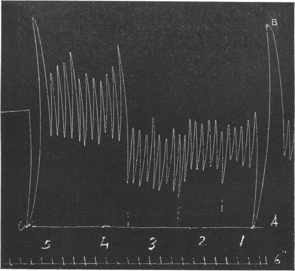 56 W. H. WILSON. A line joining the points of maximum expiration at the beginning and end of the record gives the base line from which the volume of the reserve air is determined.