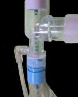 4 Pre-oxygenate your child by increasing the oxygen on the ventilator for about 30 seconds