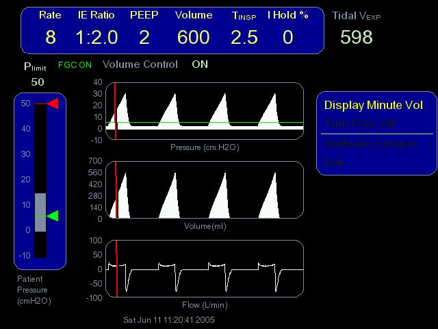 Menu Item Calibrate Patient Flow Sensor Effect Displays a series of instructions for calibrating the patient flow sensor (only when the ventilator is in Standby mode) Figure 21: : Options Menu 5.6.