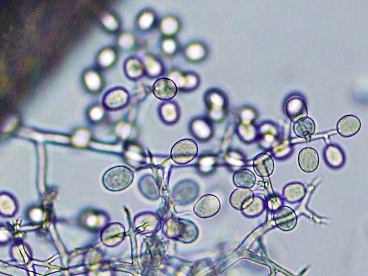Sporangia on stalk growing from