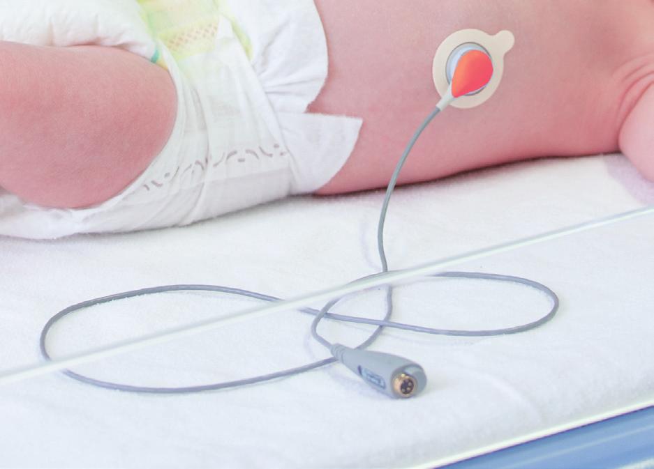 to untangle cables or to move the patient) without removing the sensor from the