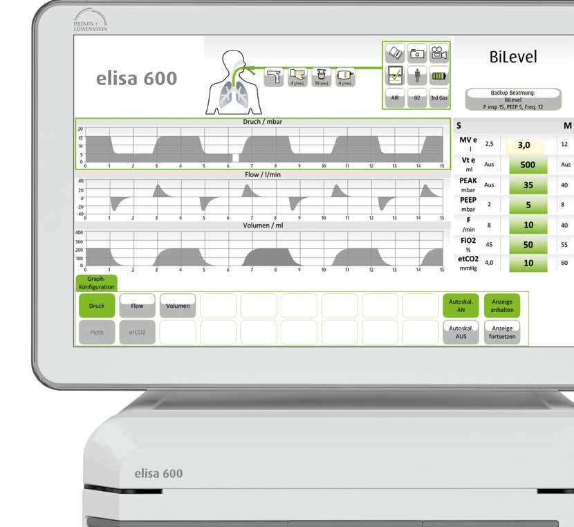 Instant View Technology The Instant View Technology lets you intuitively understand a patient s situation, with immediate display of