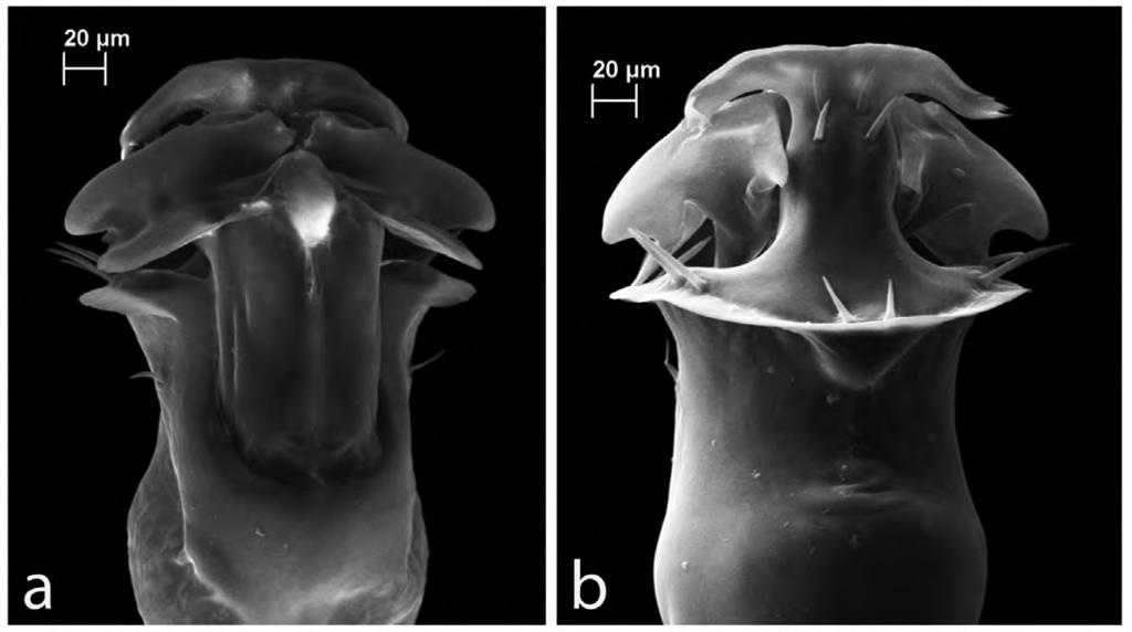 Male left leg II; (e) Male left leg III; (f) Male left leg IV. FIGURE 21. Zalmoxis kotys sp. nov.