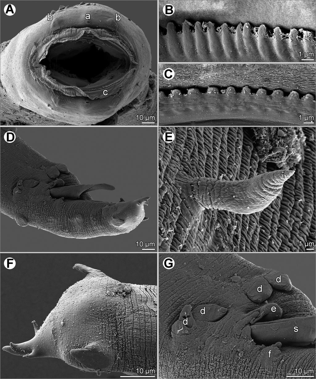 232 František Moravec et al. Fig. 2. Dichelyne (D.) spinigerus sp. nov., scanning electron micrographs: A cephalic end, apical view. B and C circumoral denticles of male and female, respectively.
