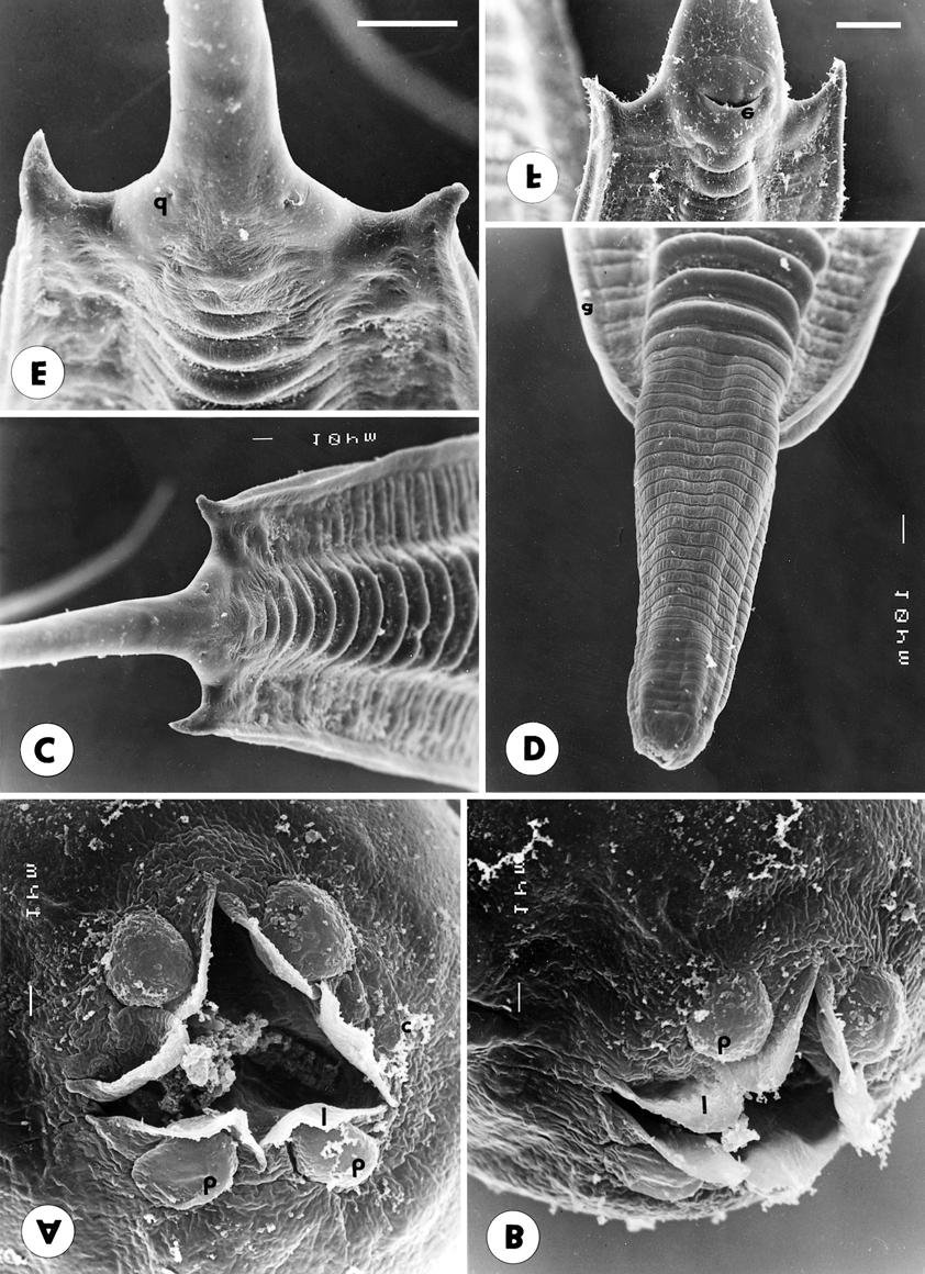 Moravec, Thatcher: New oxyuroid nematodes Fig. 2. Spinoxyuris annulata sp. n., scanning electron micrographs of female.