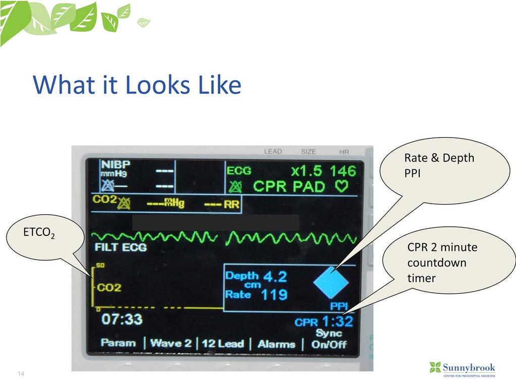 Key points: CPR metrics window rate of compression and depth.