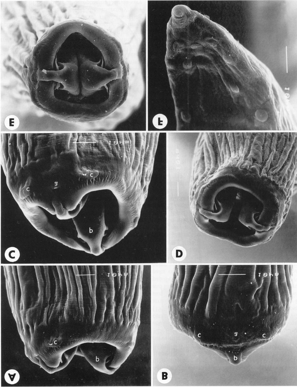 Fig. 2. Salvelinema salmonicola (Ishii, 1916), SEM micrographs.