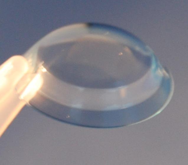 Limbal clearance of about 100 µm. The design of the SynergEyes VS lens uses peripheral toricity and linear scleral landing zones as primary elements.