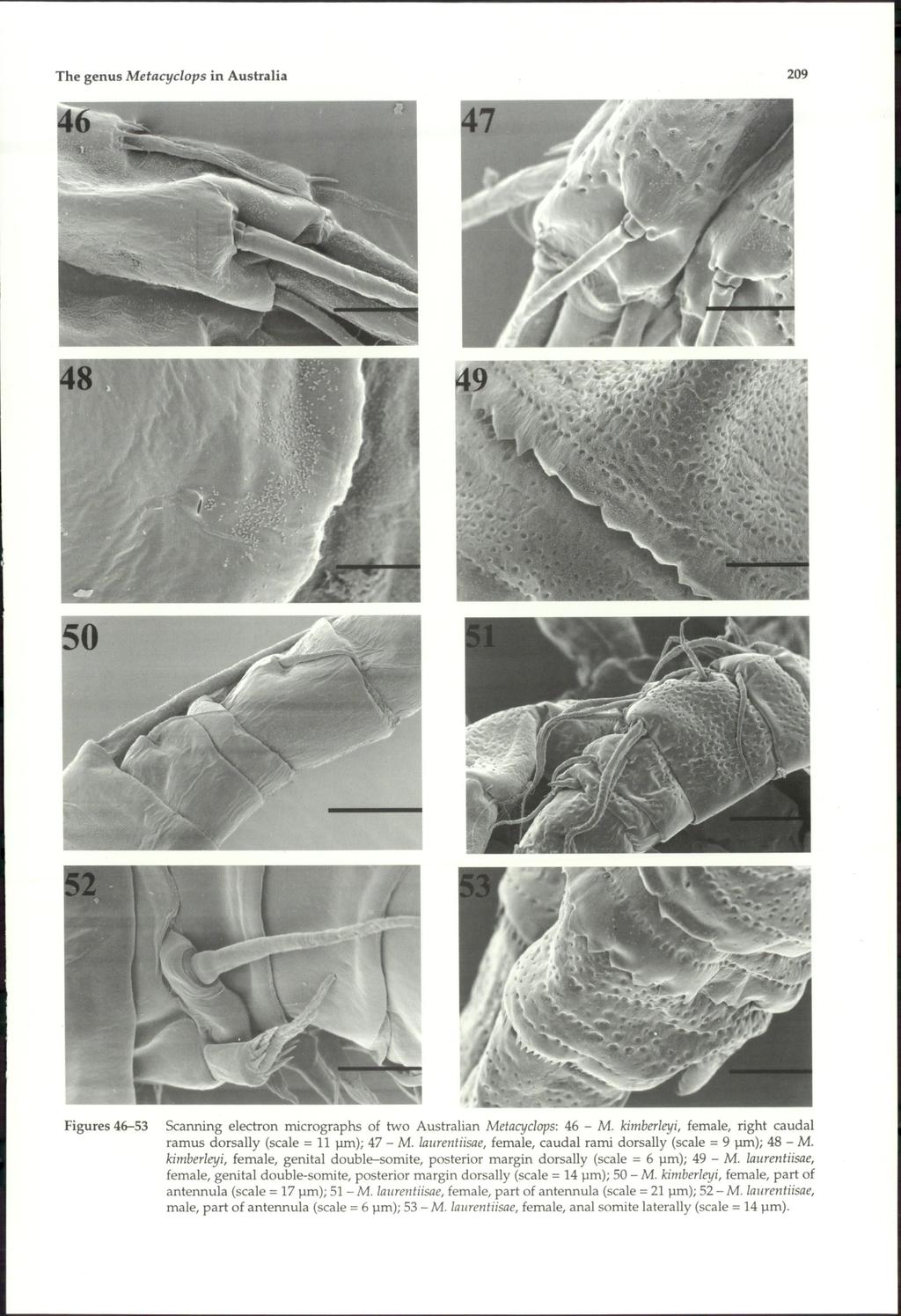 The genus Metacyclops in Australia Figures 46-53 209 Scanning electron micrographs of two Australian Metacyclops: 46 - M. kimberleyi, female, right caudal ramus dorsally (scale = 11 pm); 47 - M.