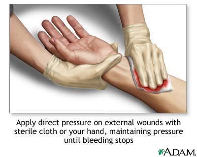 Bleeding Direct pressure Dress the wound http://www.
